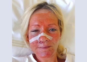 В Чехии жестоко избили украинок — фото 1